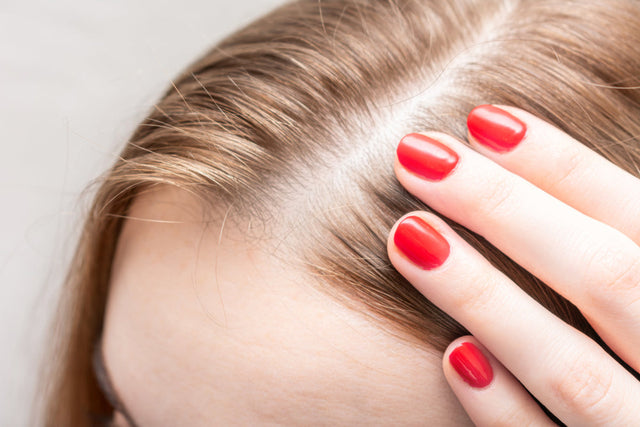 Female pattern hair loss