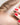 Female pattern hair loss