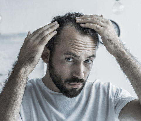 Male pattern hair loss