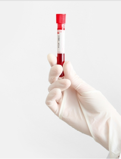 Blood Tests